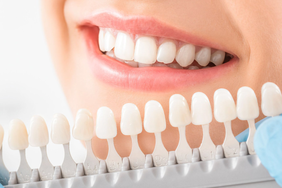 Đi tìm câu trả lời cho câu hỏi: Bọc răng sứ có tốt không?