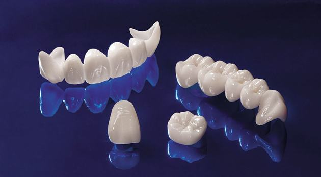 các loại răng sứ phổ biến hiện nay mà bạn nên biết