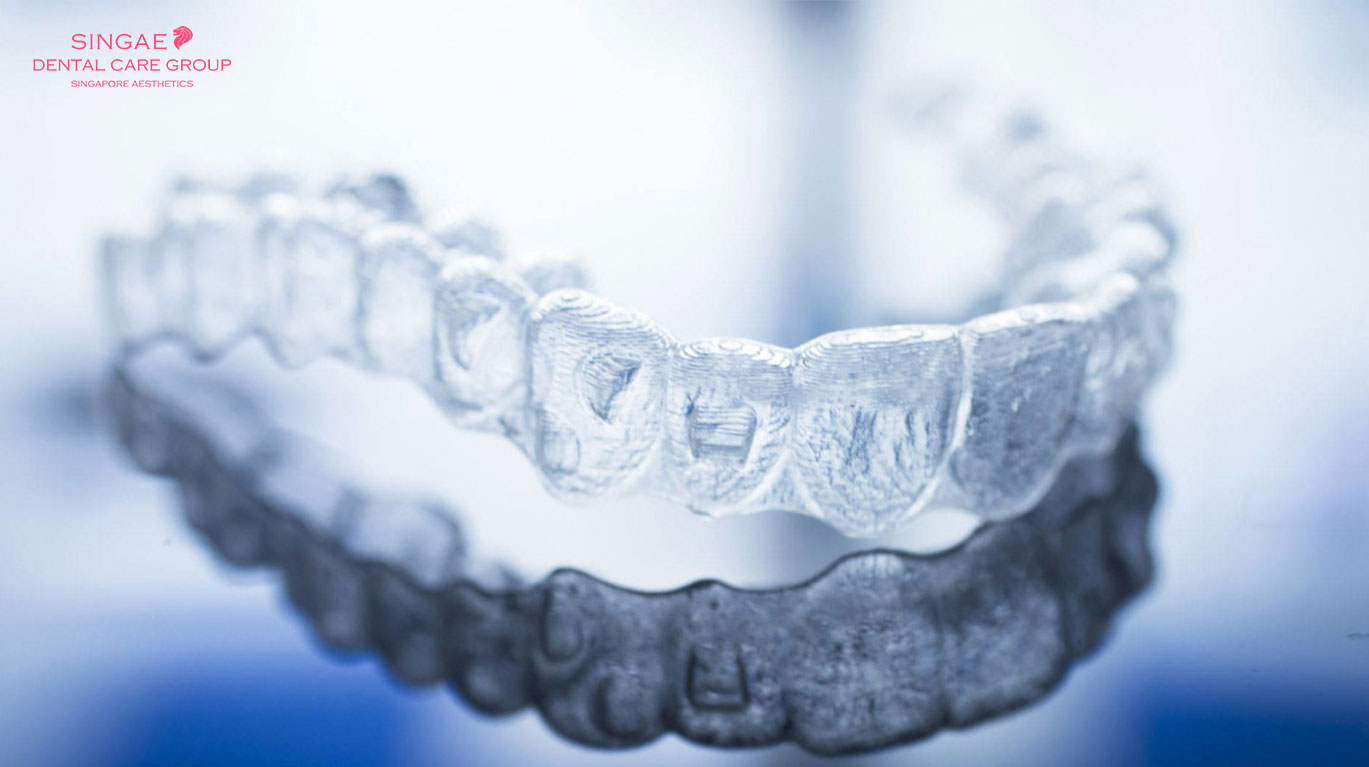 3 cách để giữ khay niềng răng Invisalign luôn “trong suốt”