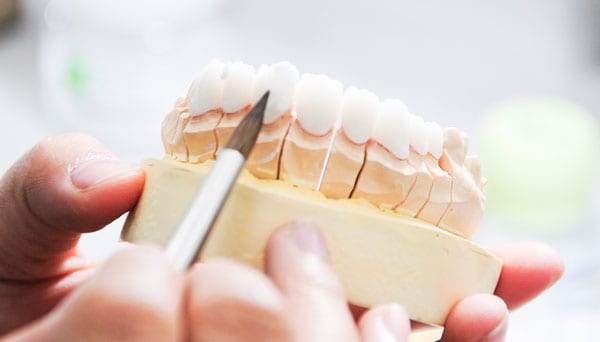 Kinh hoàng tác hại của bọc răng sứ giá rẻ