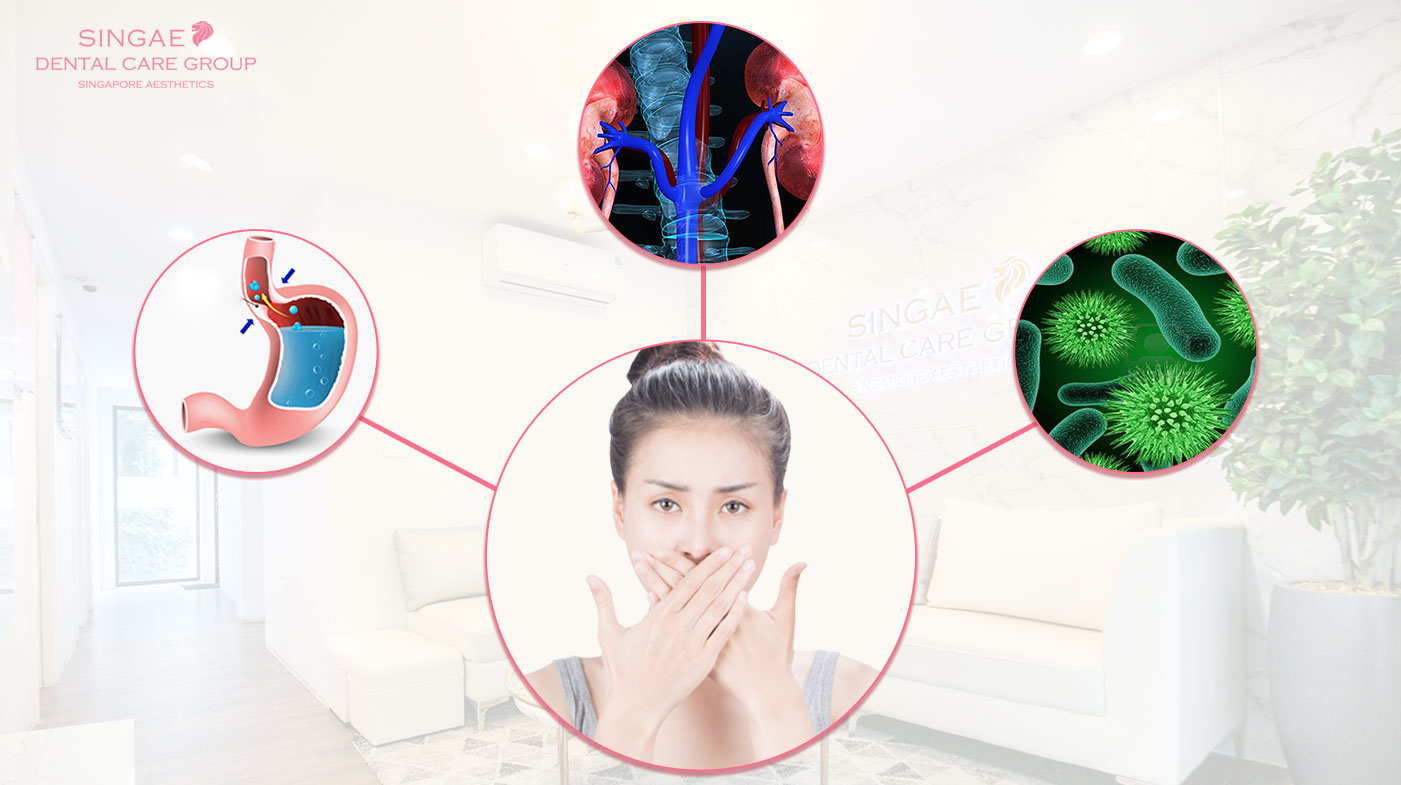 5+ Nguyên nhân gây hôi miệng và cách giải quyết