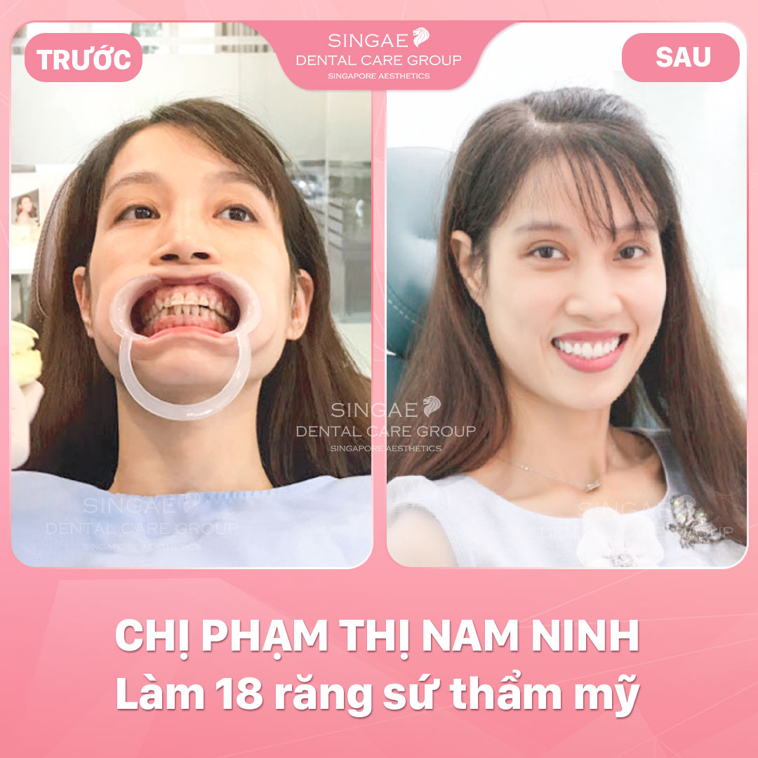 Nam Ninh