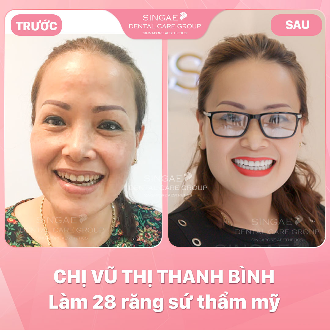 Vu Thi Thanh Binh