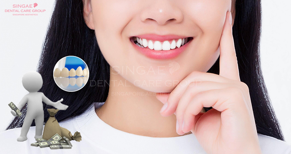 Giá răng sứ Zirconia mới nhất bao nhiêu?