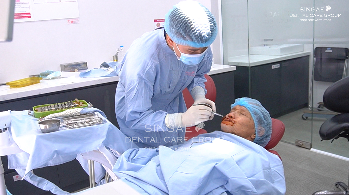 Hỏng răng Implant do cấy Implant giá rẻ, ông Đàn cầu cứu Nha khoa Singae và cái kết 