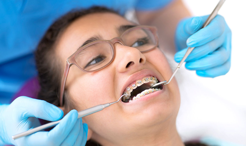 Tại sao phải nhổ răng khi niềng? Có đau không, nguy hiểm không?