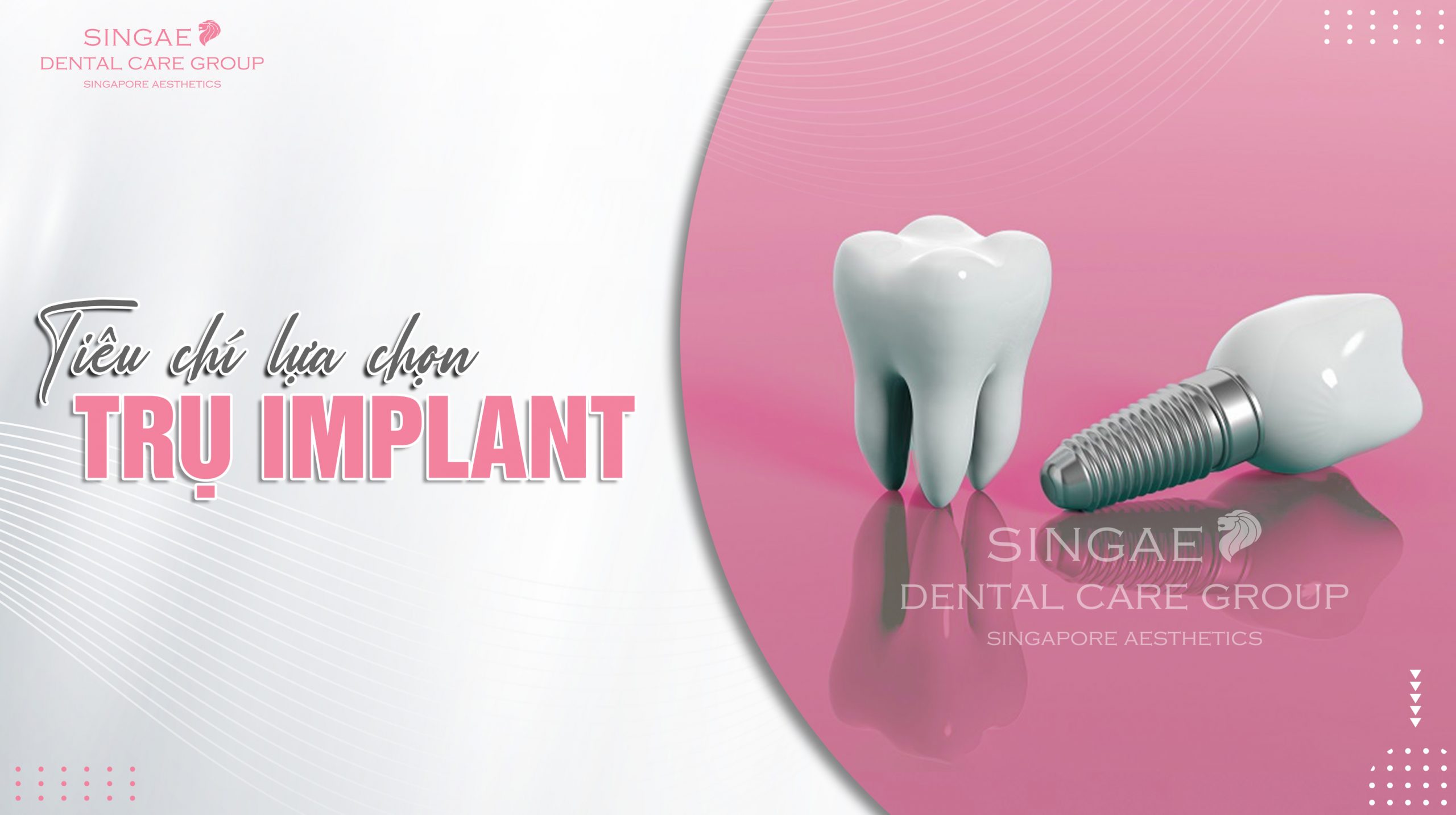 Top 7+ Tiêu chí lựa chọn trụ Implant mà bạn nên biết