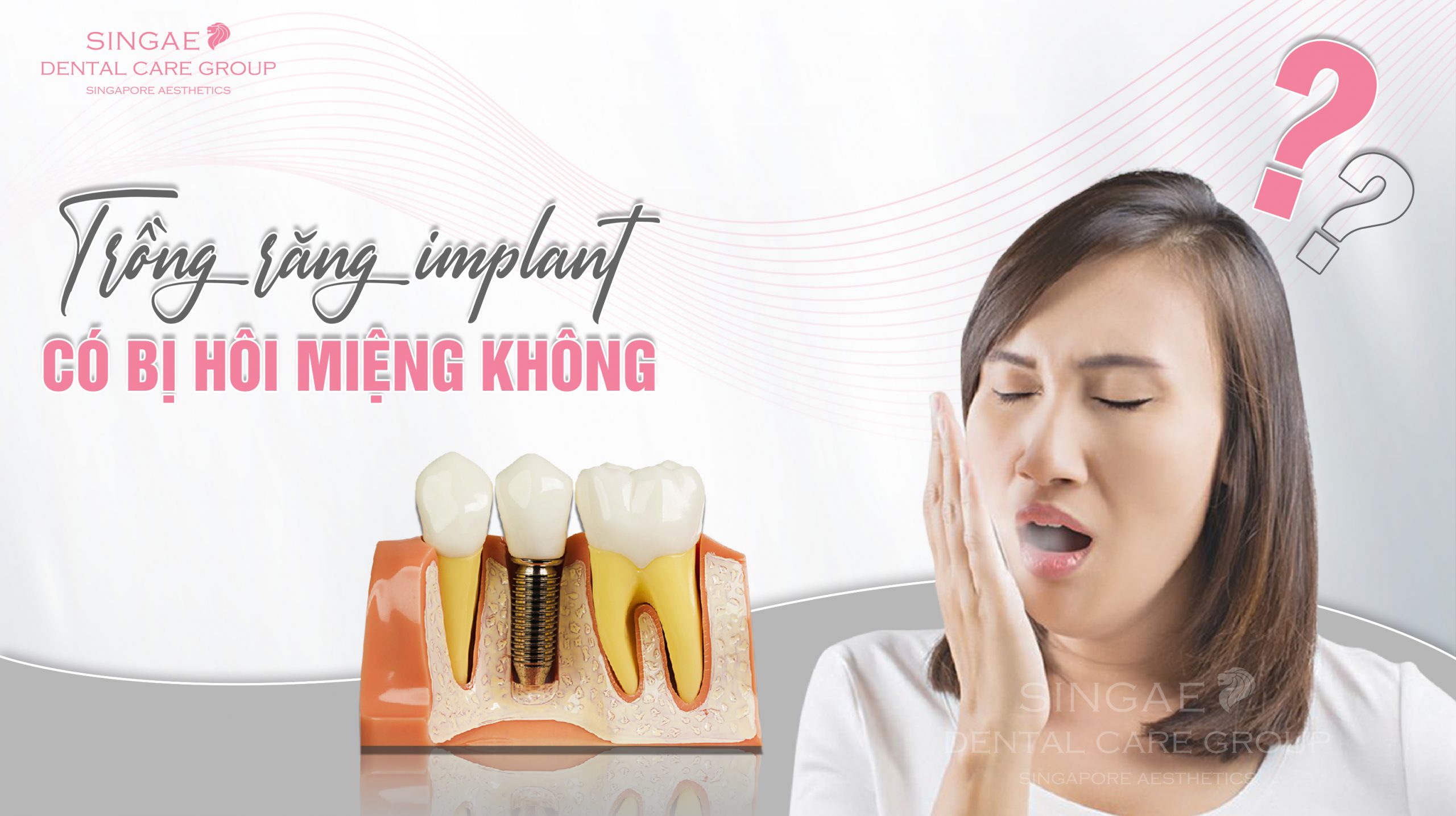 Trồng răng Implant có bị hôi miệng không?