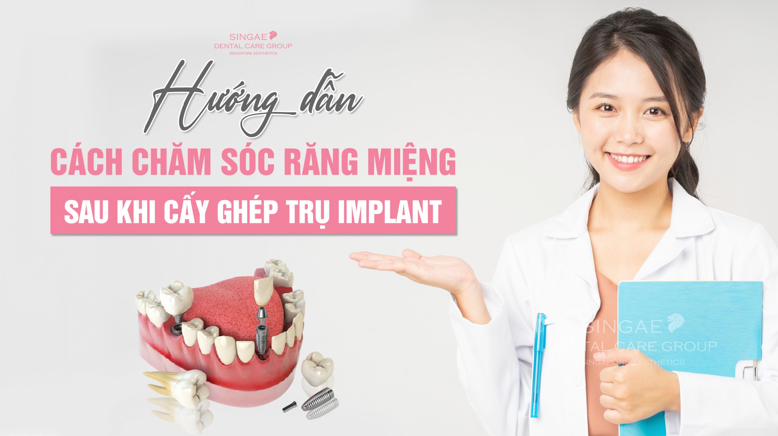 Hướng dẫn cách chăm sóc răng miệng sau khi cấy ghép trụ Implant