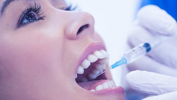 Điều trị tuỷ răng hết bao nhiêu? 