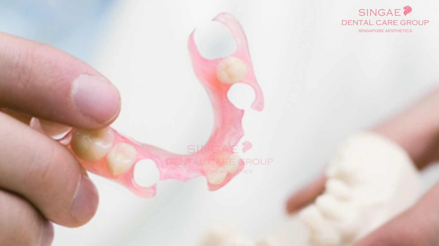 [ Hàm tháo lắp nhựa dẻo ]: Cấu tạo, Ưu điểm, Hạn chế