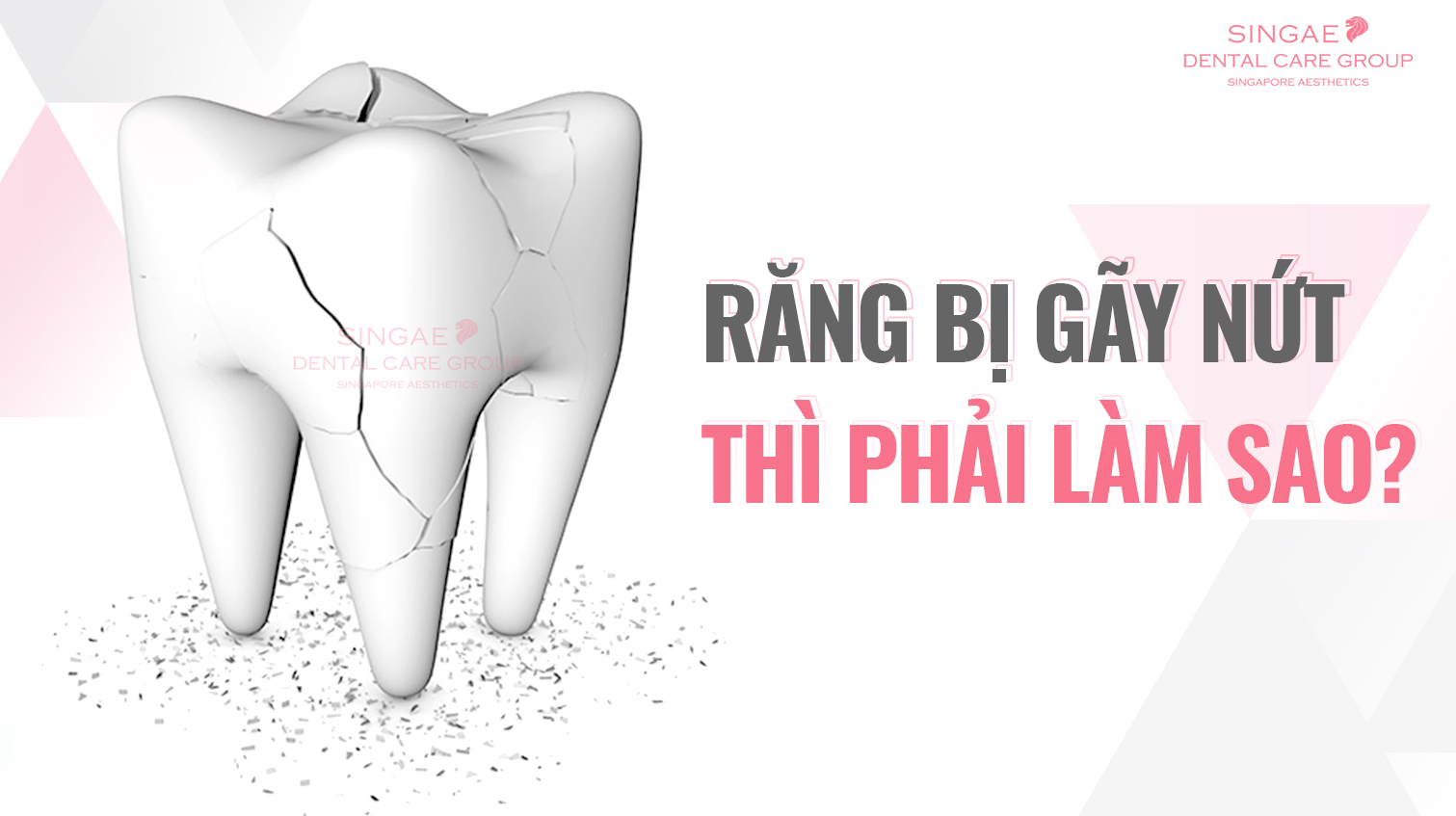 Răng bị gãy nứt: Nguyên nhân, triệu chứng, điều trị và phòng tránh