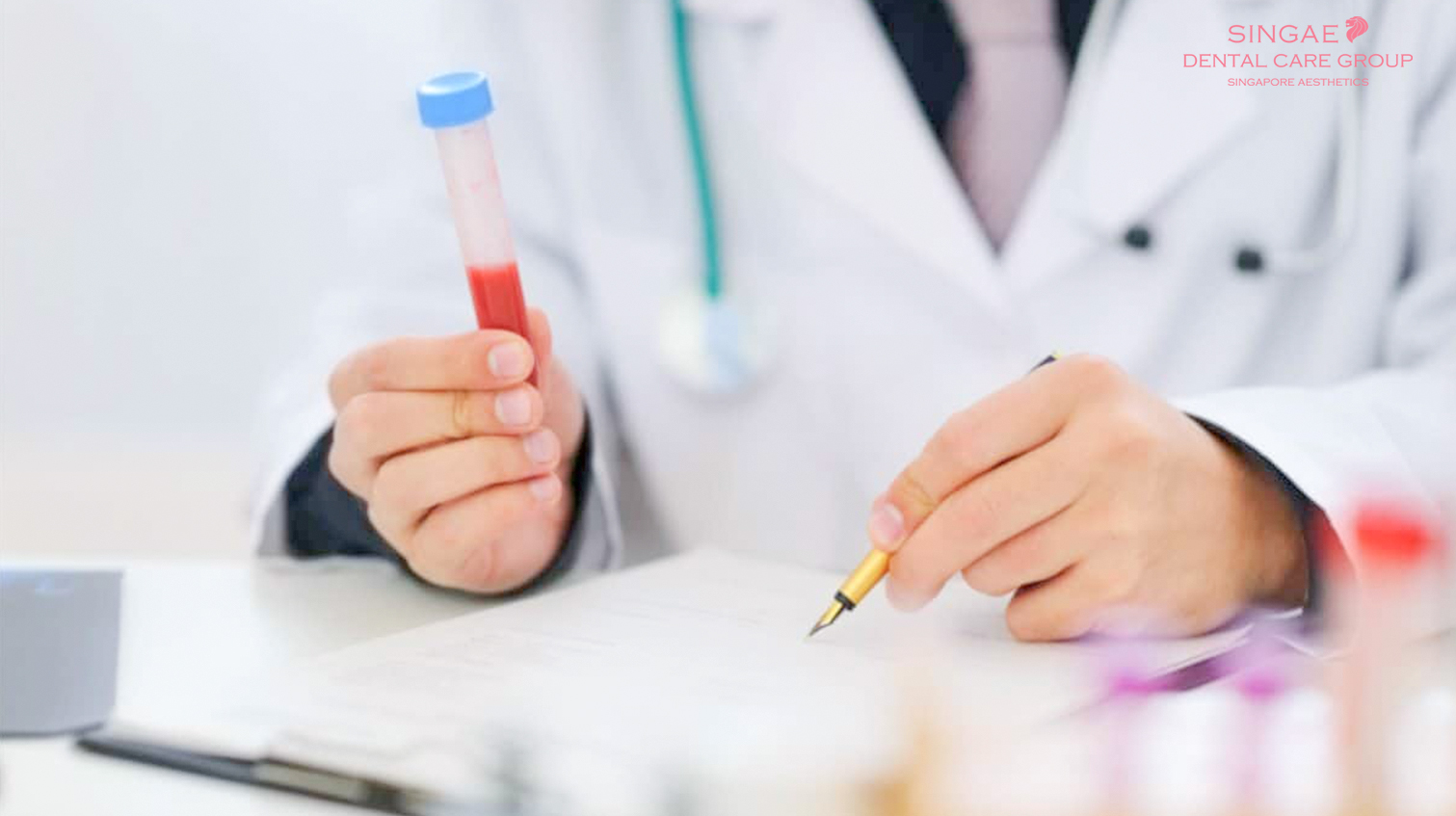 Những loại xét nghiệm trước khi trồng Implant mà bạn nên biết