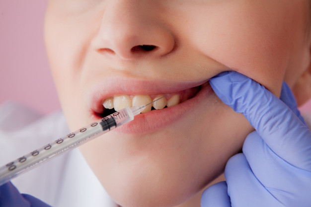 Trám răng lấy tủy và những thông tin nhất định bạn nên biết