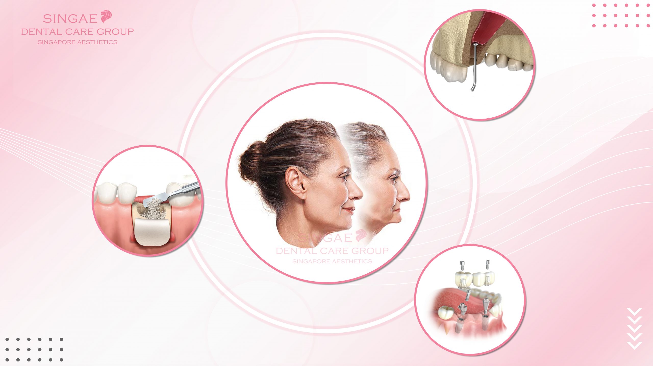 Tiêu xương hàm điều trị thế nào? Phương pháp và chi phí