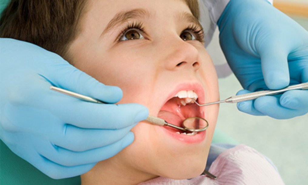 Viêm chân răng ở trẻ 
