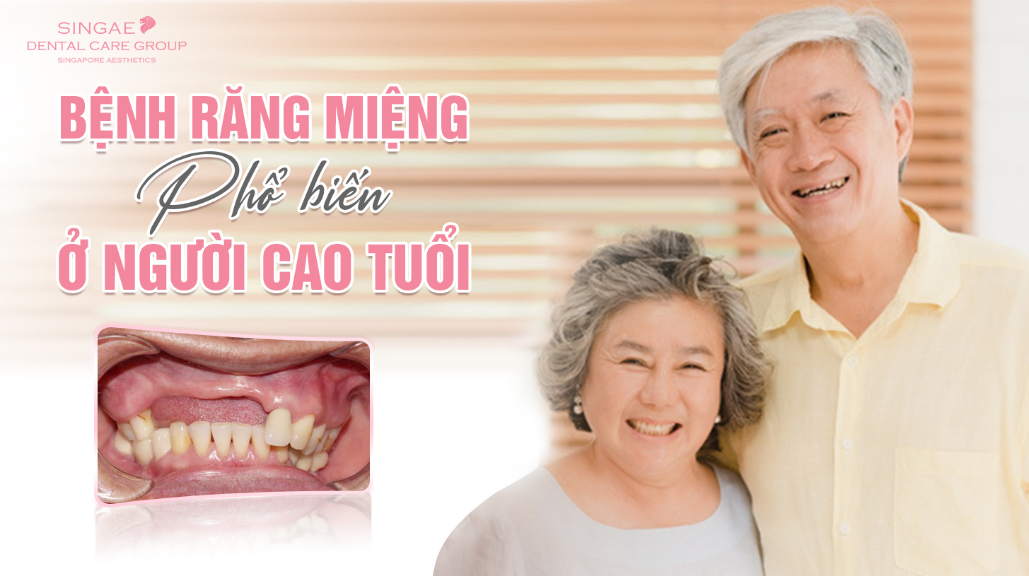 Top 5 bệnh răng miệng ở người cao tuổi thường gặp