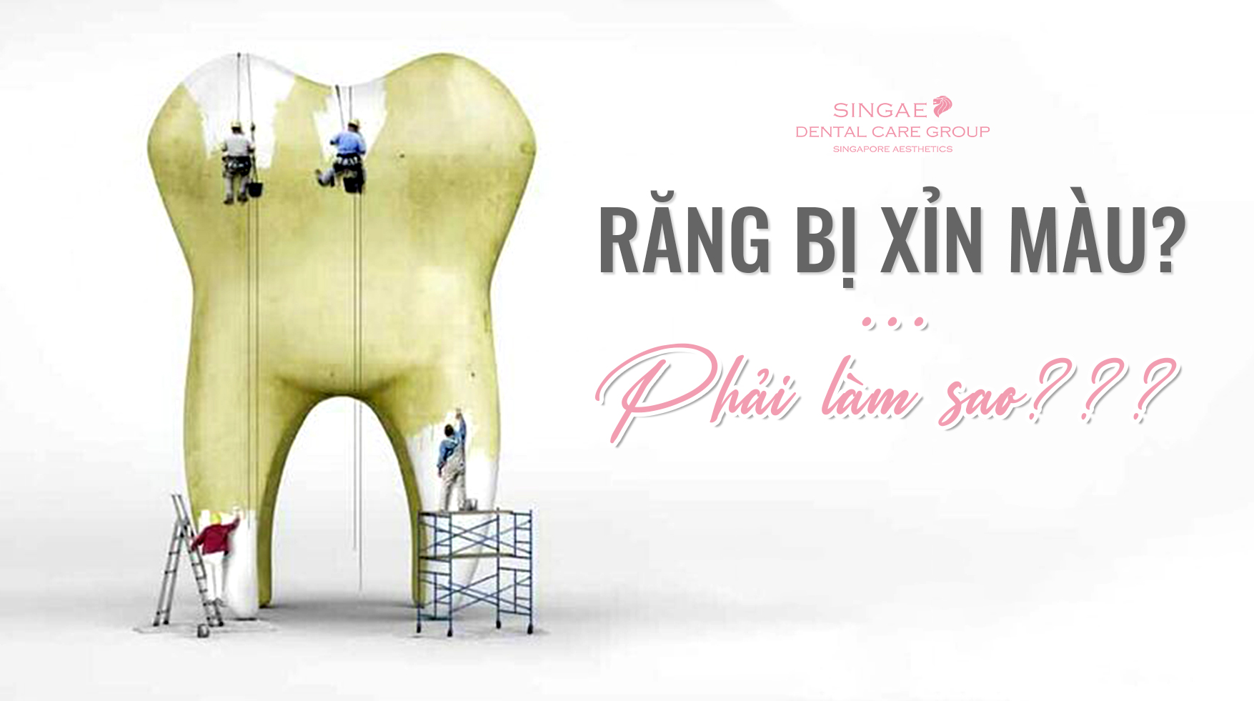 Răng bị xỉn màu: Nguyên nhân, phân loại, cách điều trị