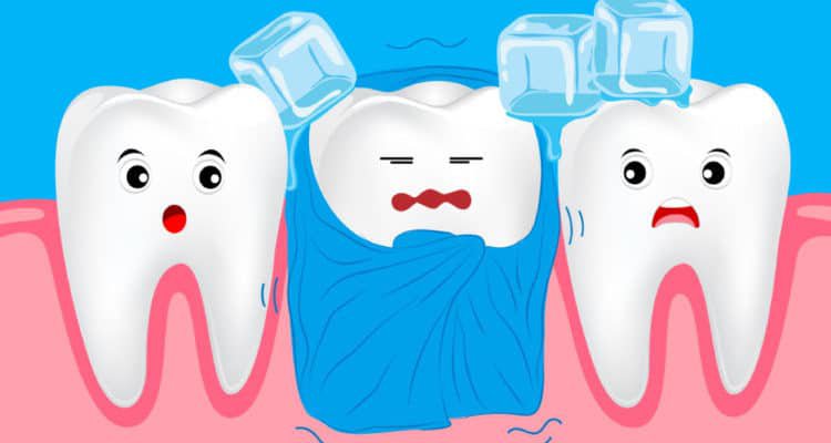 Răng nhạy cảm: Dấu hiệu, Nguyên nhân, Cách khắc phục 9 răng nhạy cảm