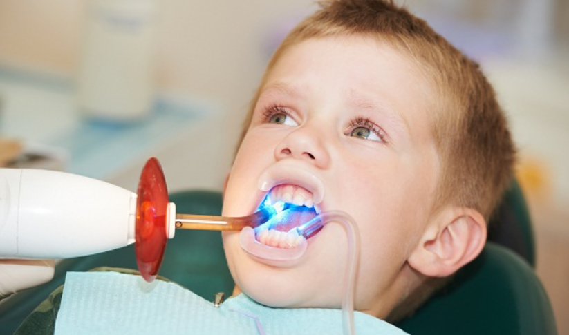 Sún răng ở trẻ em: Nguyên nhân, Dấu hiệu, Cách điều trị