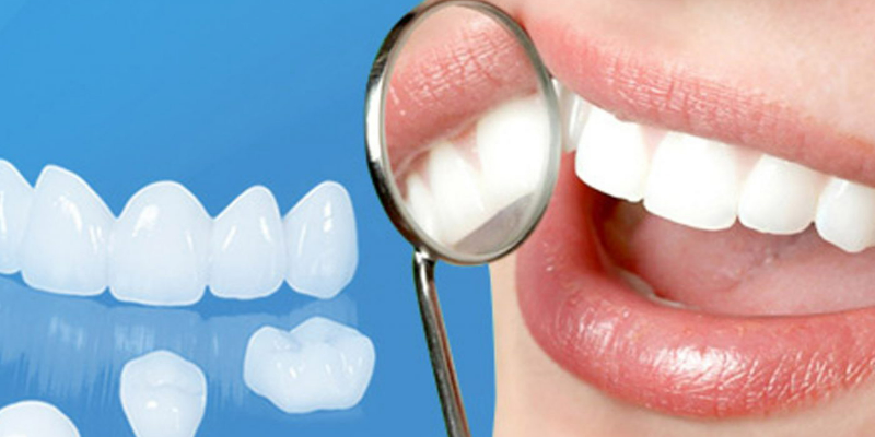 Quy trình bọc răng sứ cho răng sâu