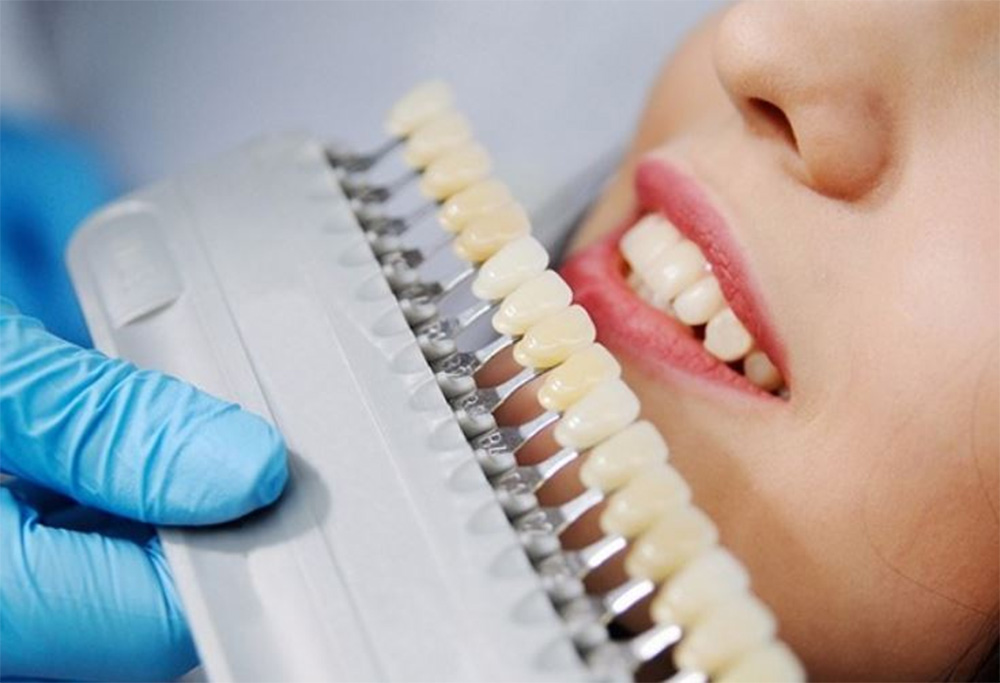 Trên thị trường có nhiều loại răng sứ khác nhau, từ bình dâtrồng răng sứ cả hàm giá bao nhiêun đến cao cấp