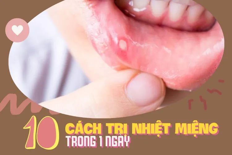 Cách trị nhiệt miệng trong 1 ngày