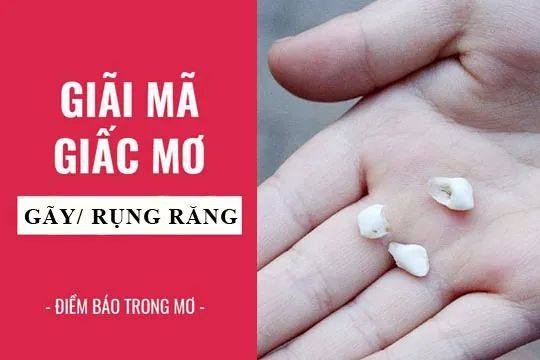 Nằm mơ thấy rụng răng theo góc nhìn khoa học