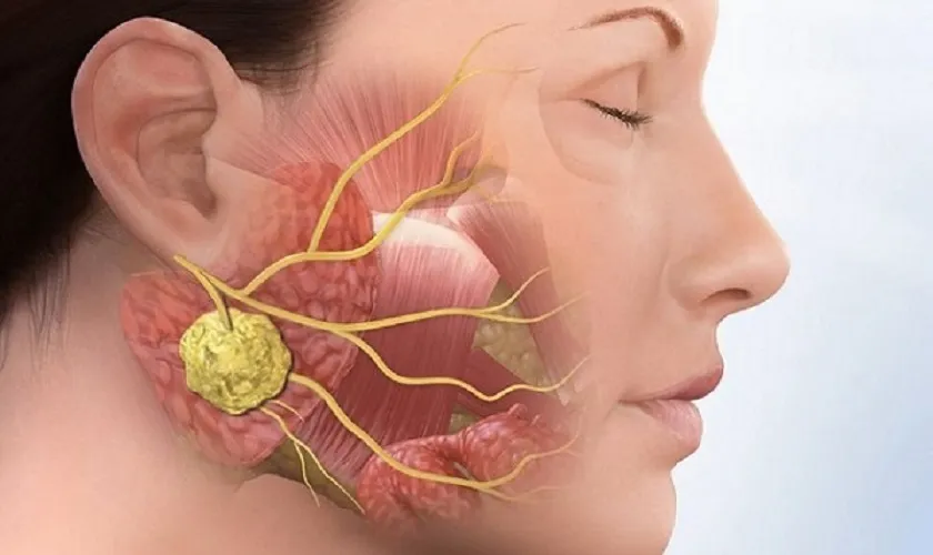 Bị đau quai hàm gần tai bên phải