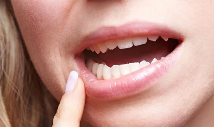 Răng lung lay làm sao để chắc lại