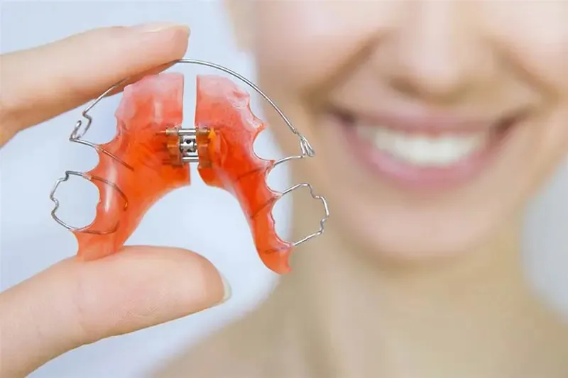 Các loại khí cụ nong hàm