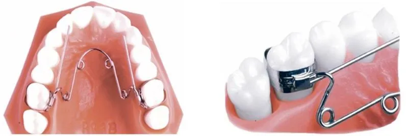 Các phương pháp nong hàm phổ biến