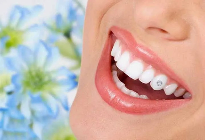 Lưu ý gì khi thực hiện gắn đá quý