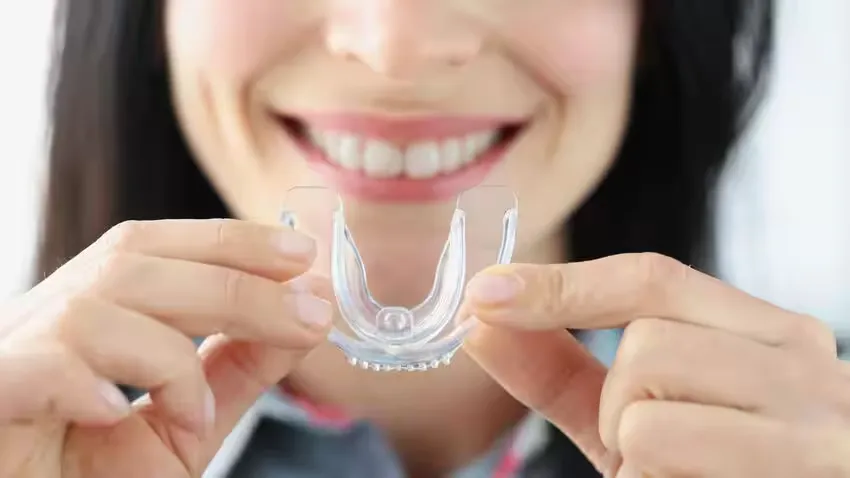 Lưu ý khi chọn mua máng chống nghiến răng