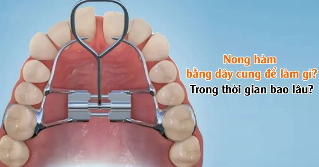 Nong hàm trong bao lâu