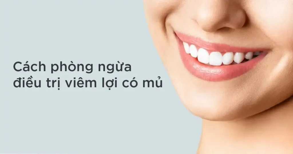 Phòng ngừa sưng nướu có mủ