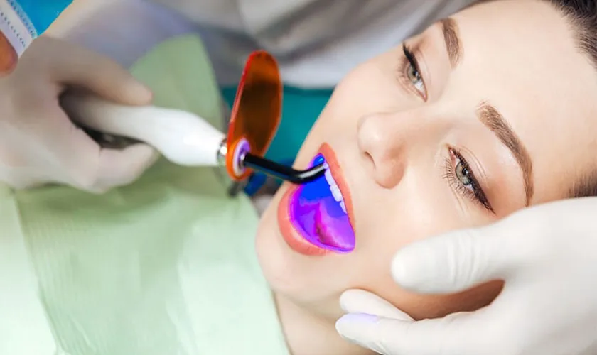 Tẩy trắng răng giữ được bao lâu