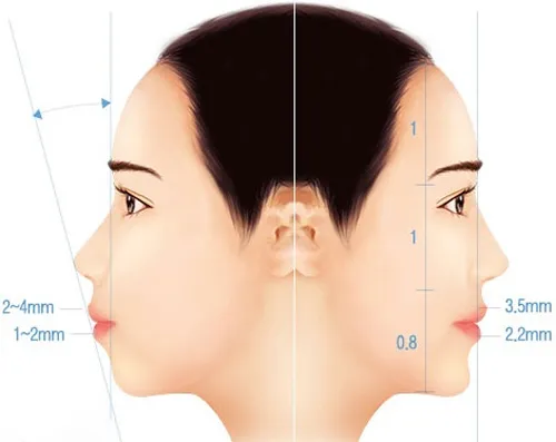 Các nguyên nhân gây ra cằm lẹm