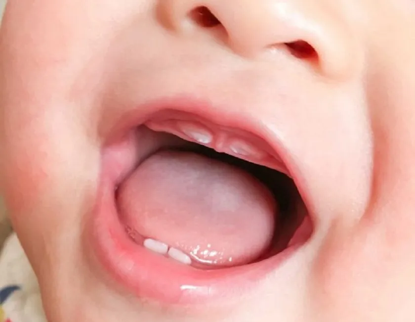 Trẻ mấy tháng mọc răng? Dấu hiệu, cách chăm sóc và lưu ý 8 Các yếu tố quyết định thời gian mọc răng của trẻ