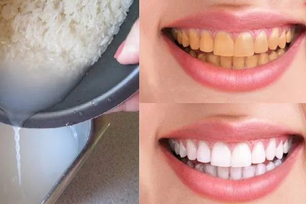 Cách làm trắng răng tại nhà bằng nước vo gạo