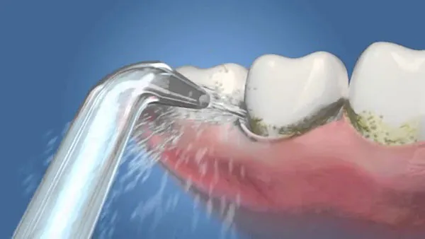Đối tượng phù hợp sử dụng máy tăm nước