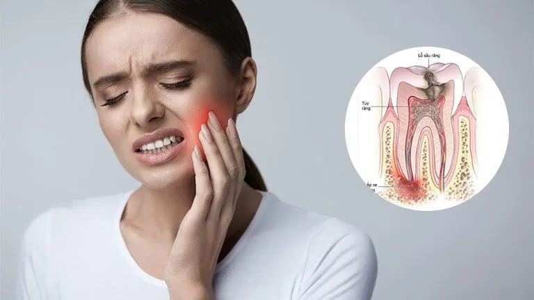 Răng bị ê buốt có nguy hiểm không
