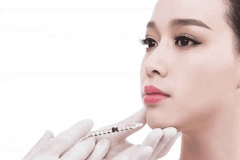Tiêm Filler cằm 