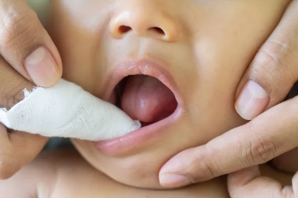 Trẻ chậm mọc răng có nguy hiểm không