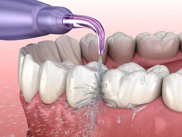 cách sử dụng tăm nước đúng cách