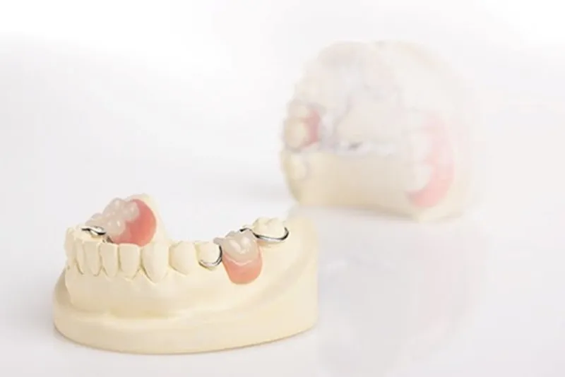 Răng giả tháo lắp 1 chiếc là gì? Ưu nhược điểm và chi phí