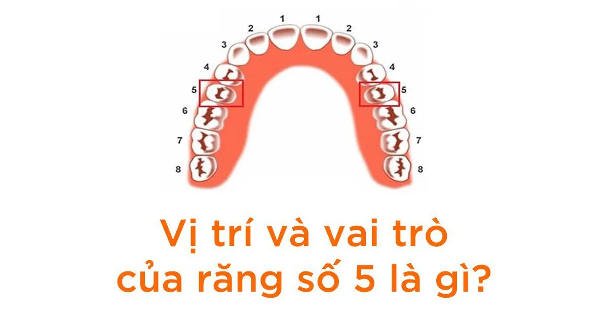 Răng số 5 có thay không? Mất răng số 5 phải làm sao?