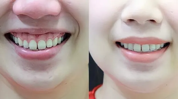 cat loi bao nhieu tien3