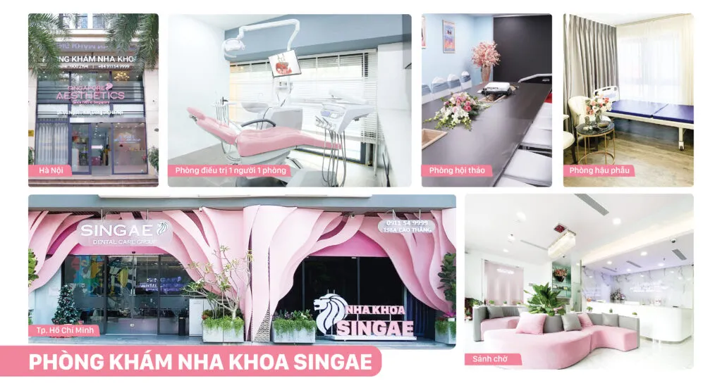 Các bước thực hiện trồng răng sứ cố định