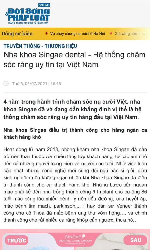 Báo Đời sống pháp luật đánh giá về Nha khoa Singae thế nào